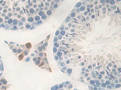 Immunohistochemistry (Formalin/PFA-fixed paraffin-embedded sections) - Anti-Carboxypeptidase B/CPB antibody (AB231536)