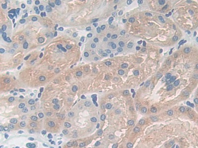Immunohistochemistry (Formalin/PFA-fixed paraffin-embedded sections) - Anti-Carboxypeptidase B/CPB antibody (ab231536), expandable thumbnail