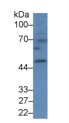 Western blot - Anti-Carboxypeptidase B/CPB antibody (AB231536), expandable thumbnail