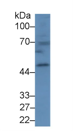 Western blot - Anti-Carboxypeptidase B/CPB antibody (AB231536)