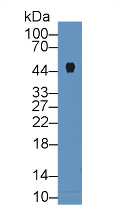 Western blot - Anti-Carboxypeptidase B/CPB antibody (AB231536), expandable thumbnail