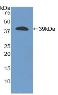 Western blot - Anti-Carboxypeptidase B/CPB antibody (AB231536)