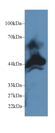 Western blot - Anti-Carboxypeptidase B/CPB antibody (AB231536)