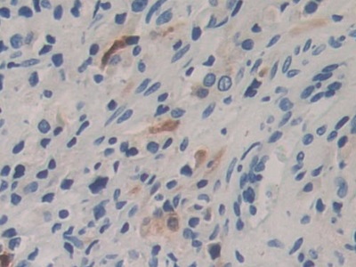 Immunohistochemistry (Formalin/PFA-fixed paraffin-embedded sections) - Anti-Carboxypeptidase B/CPB antibody (AB232874), expandable thumbnail