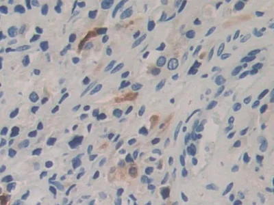 Immunohistochemistry (Formalin/PFA-fixed paraffin-embedded sections) - Anti-Carboxypeptidase B/CPB antibody (AB232874)
