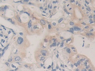 Immunohistochemistry (Formalin/PFA-fixed paraffin-embedded sections) - Anti-Carboxypeptidase B/CPB antibody (AB232874), expandable thumbnail
