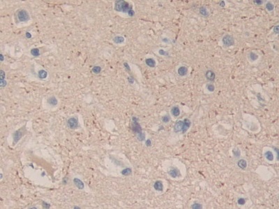 Immunohistochemistry (Formalin/PFA-fixed paraffin-embedded sections) - Anti-Carboxypeptidase B/CPB antibody (AB232874), expandable thumbnail