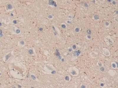 Immunohistochemistry (Formalin/PFA-fixed paraffin-embedded sections) - Anti-Carboxypeptidase B/CPB antibody (AB232874)