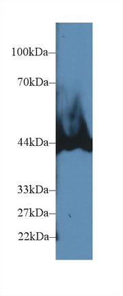 Western blot - Anti-Carboxypeptidase B/CPB antibody (ab232874), expandable thumbnail