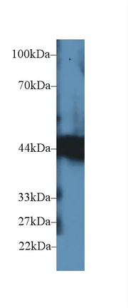 Western blot - Anti-Carboxypeptidase B/CPB antibody (AB232874)