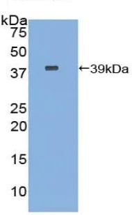 Western blot - Anti-Carboxypeptidase B/CPB antibody (AB232874)