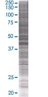 Carboxypeptidase B overexpression 293T lysate (whole cell)