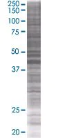 SDS-PAGE - Carboxypeptidase B overexpression 293T lysate (whole cell) (AB94085)