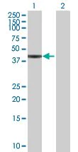 Western blot - Carboxypeptidase B overexpression 293T lysate (whole cell) (AB94085)