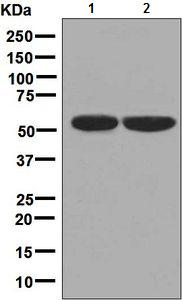 Western blot - Anti-Carboxypeptidase B2 antibody [EPR7858] (AB133679), expandable thumbnail