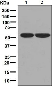 Western blot - Anti-Carboxypeptidase B2 antibody [EPR7858] - BSA and Azide free (AB248612)