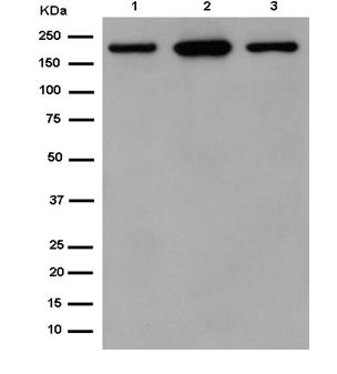 Western blot - Anti-Carboxypeptidase D/CPD antibody [EPR14810] (AB184960)