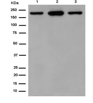 Western blot - Anti-Carboxypeptidase D/CPD antibody [EPR14810] (AB184960)