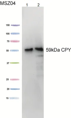 Western blot - Anti-Carboxypeptidase Y antibody [10A5B5] (AB113685)