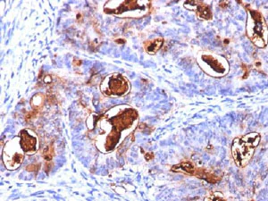 Immunohistochemistry (Formalin/PFA-fixed paraffin-embedded sections) - Anti-Carcino Embryonic Antigen CEA antibody [COL-1 + CEA31 + C66/261] - BSA and Azide free (AB212271)