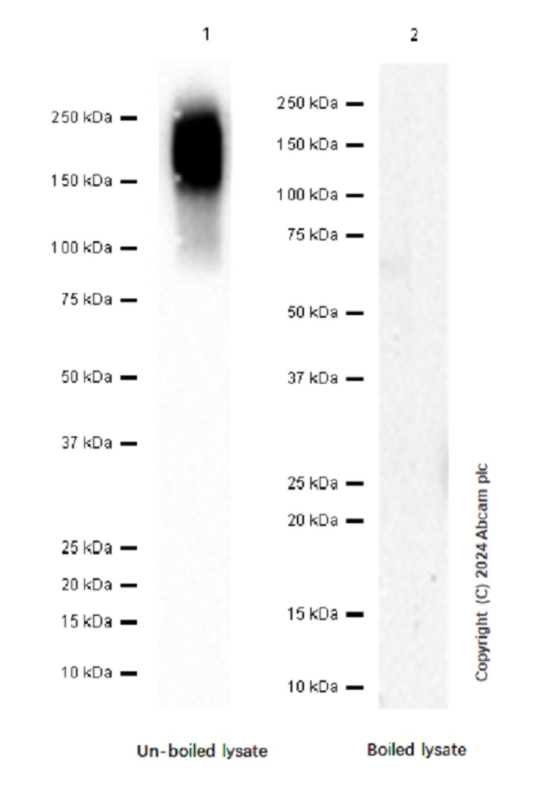 Western blot - Anti-Carcino Embryonic Antigen CEA antibody [EPCEAR7] (AB133633)