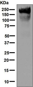 Western blot - Anti-Carcino Embryonic Antigen CEA antibody [EPCEAR7] (AB133633)
