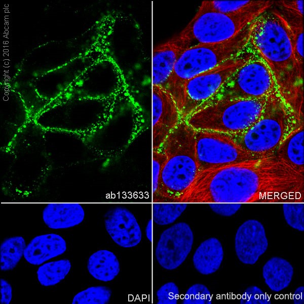 Anti-Carcino Embryonic Antigen CEA antibody [EPCEAR7] - BSA and Azide ...