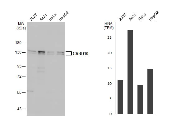 Western blot - Anti-CARD10 antibody [HL2260] (AB317180)