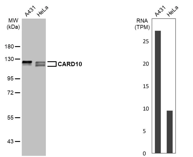 Western blot - Anti-CARD10 antibody [HL2261] (AB317181)