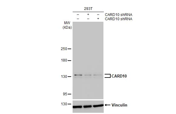 Western blot - Anti-CARD10 antibody [HL2261] (AB317181)