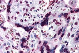 Immunohistochemistry (Formalin/PFA-fixed paraffin-embedded sections) - Anti-CARD14 antibody (AB140203)