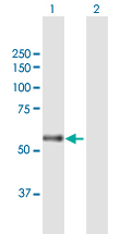 Western blot - Anti-CARD14 antibody (AB168096), expandable thumbnail