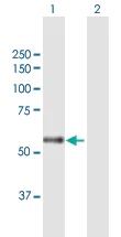 Western blot - Anti-CARD14 antibody (AB168096)