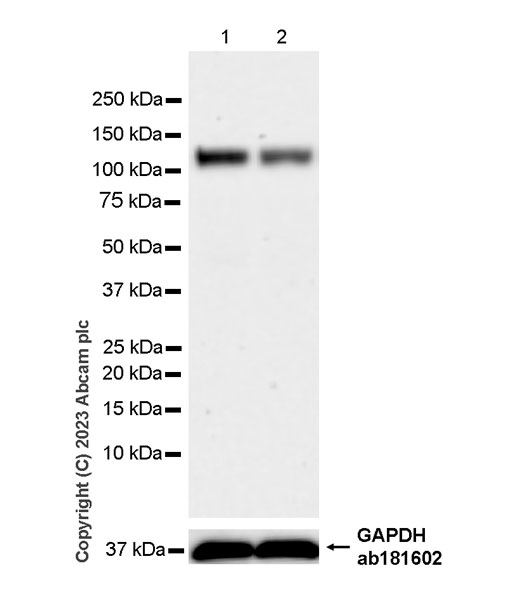 Western blot - Anti-CARD14 antibody [EPR27457-65] (AB315088), expandable thumbnail