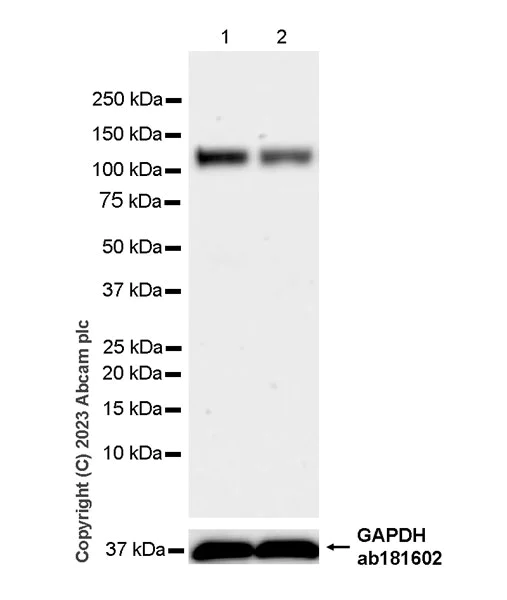 Western blot - Anti-CARD14 antibody [EPR27457-65] (AB315088)