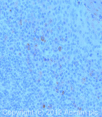 Immunohistochemistry (Formalin/PFA-fixed paraffin-embedded sections) - Anti-CARD15/NOD2 antibody [2D9] (AB31488), expandable thumbnail
