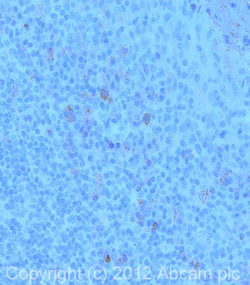 Immunohistochemistry (Formalin/PFA-fixed paraffin-embedded sections) - Anti-CARD15/NOD2 antibody [2D9] (AB31488)
