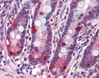 Immunohistochemistry (Formalin/PFA-fixed paraffin-embedded sections) - Anti-CARD15/NOD2 antibody (AB115542)
