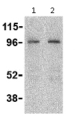 Western blot - Anti-CARD15/NOD2 antibody (AB115542)