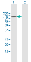 Western blot - Anti-CARD15/NOD2 antibody (AB172755)