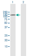 Western blot - Anti-CARD15/NOD2 antibody (AB172755)
