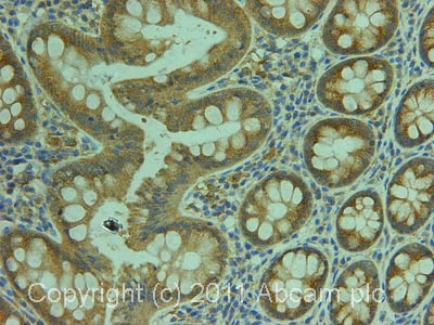 Immunohistochemistry (Formalin/PFA-fixed paraffin-embedded sections) - Anti-CARD15/NOD2 antibody (AB36836)