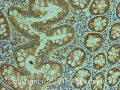 Immunohistochemistry (Formalin/PFA-fixed paraffin-embedded sections) - Anti-CARD15/NOD2 antibody (AB36836)