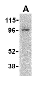 Western blot - Anti-CARD15/NOD2 antibody (AB36836)