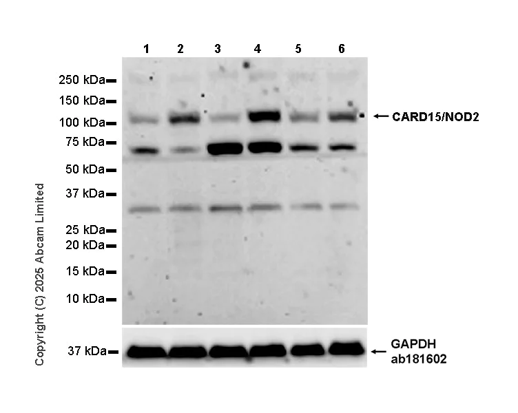 Western blot - Anti-CARD15/NOD2 antibody [EPR28206-156] (AB324739)
