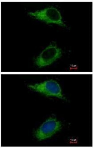 Immunocytochemistry/ Immunofluorescence - Anti-CARD6 antibody (AB227189)