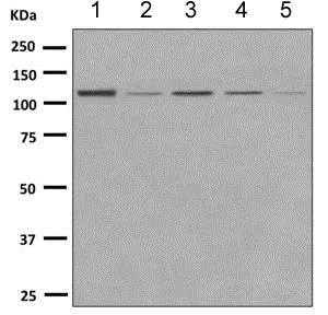 Western blot - Anti-CARD6 antibody [EPR9718] (AB151560)