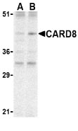 Western blot - Anti-CARD8 antibody (AB24186)