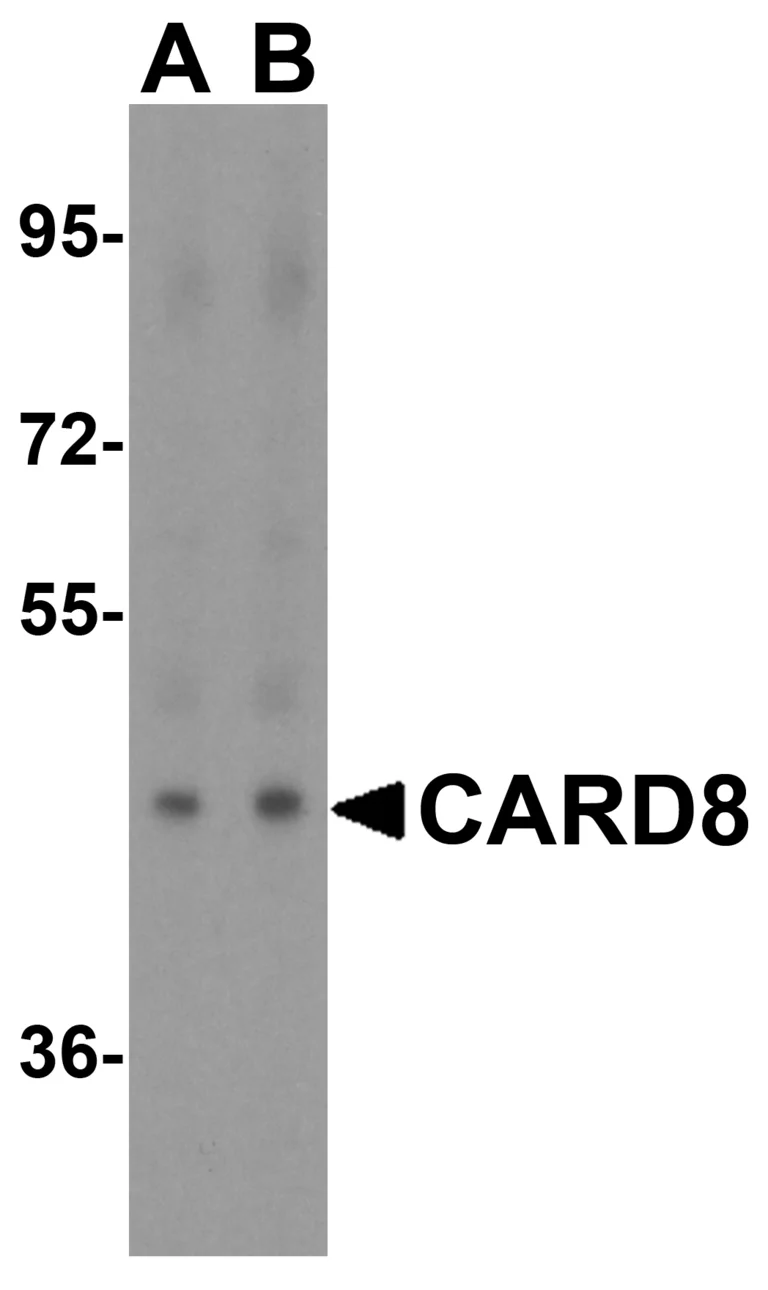 Western blot - Anti-CARD8 antibody (AB24186)