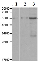 Western blot - Anti-CARD8 antibody - N-terminal (AB194585), expandable thumbnail